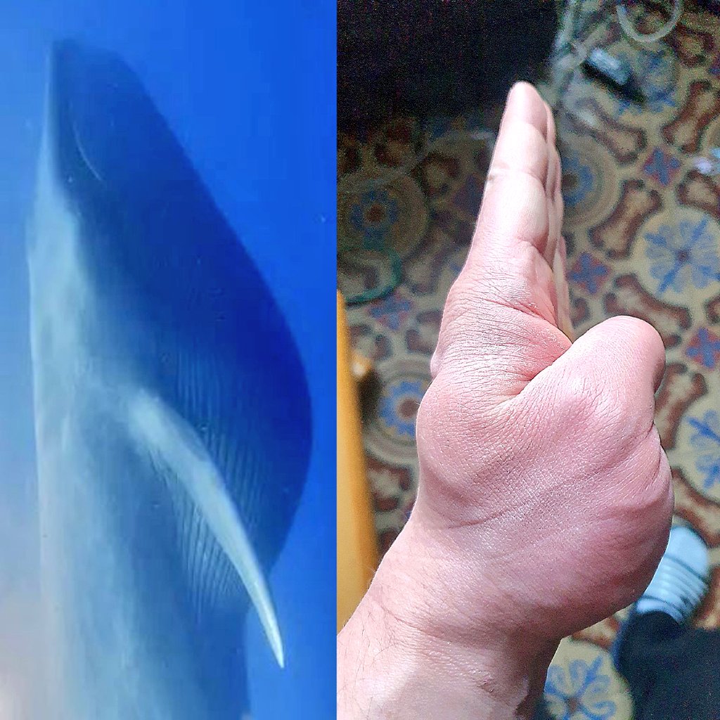 focusrelentless's tweet photo. My thumbs are starting to make me think of a Blue Whale https://t.co/lR2IjUgC0M