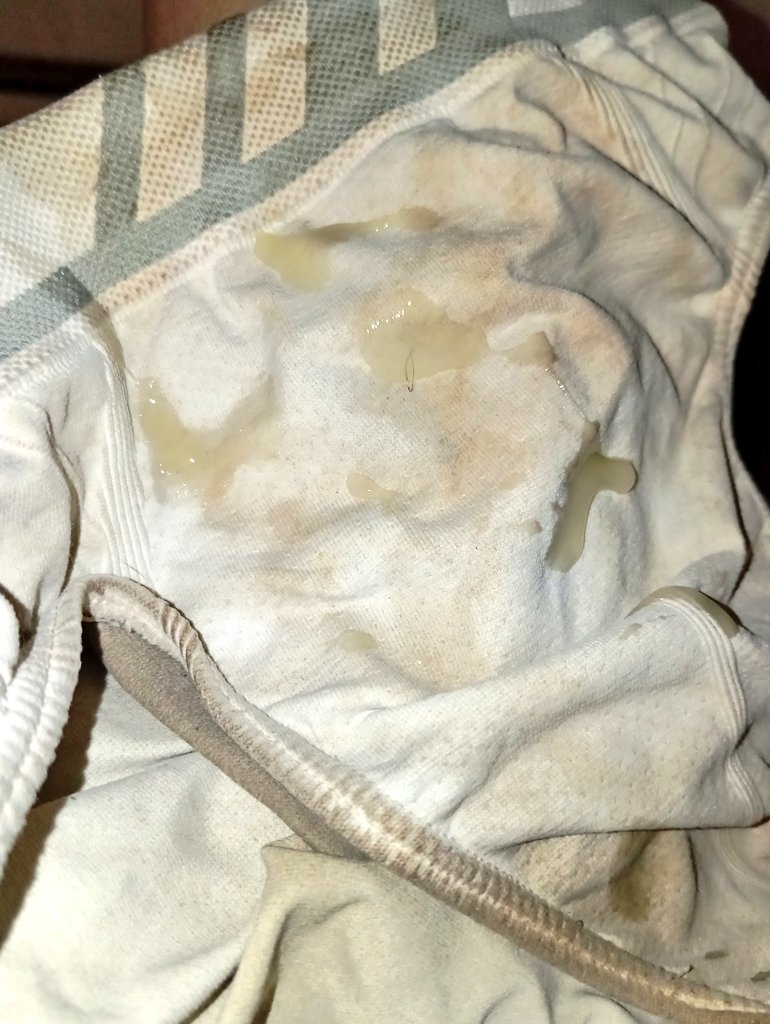 ofc_pivetin's tweet photo. porra amarela concentrada 🥴💦💦 https://t.co/1QToZUFtOK