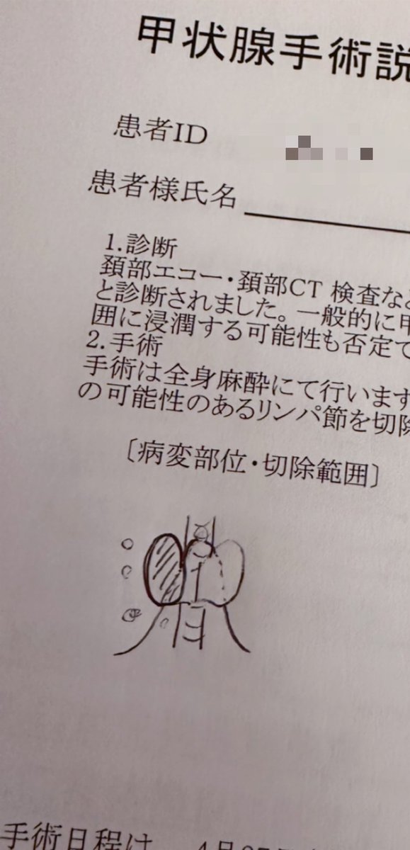 okamalilu's tweet photo. 甲状腺半摘から3年。
健康診断の内科検診で
Dr「濾胞性腺腫…甲状腺…術済…え？内視鏡手術？」

私「首を切る手術で…ここ跡が…」

Dr「え！どこを切ったのか分からない！患者さんにも紹介したい！どこで手術したの？」

…と、まるでママ友トーク（笑）
改めて、関わってくれた皆様に感謝🥰 https://t.co/3Jy8VNbZUb