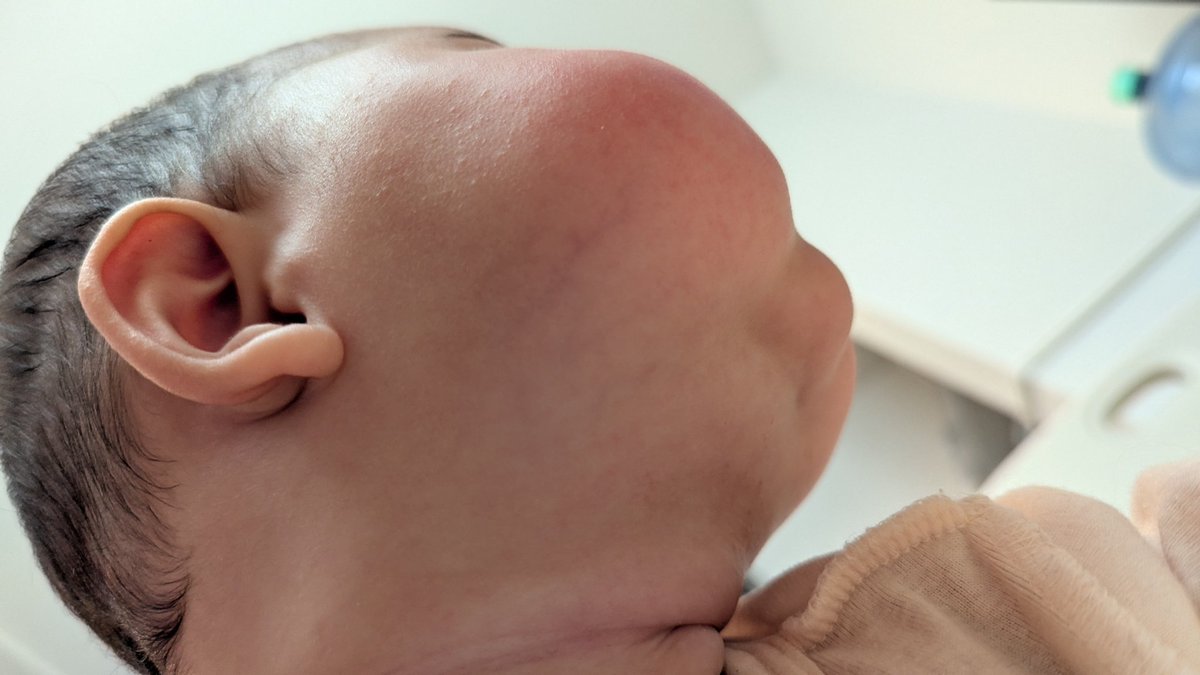 ピョン子様ご確認中 さーて今日も赤子をローアングルで楽しむか………