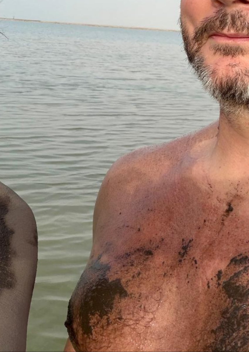 Deplorable94's tweet image. Are those breast implants or do you just have really high estrogen levels? 

I think I already know the answer