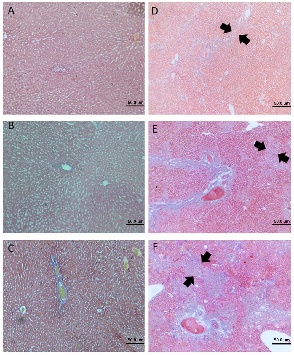 A combination of #ursodeoxycholicacid and #Alliumsativum prevents #livercirrhosis in #cholestaticrats

doi.org/10.5455/jabet.…