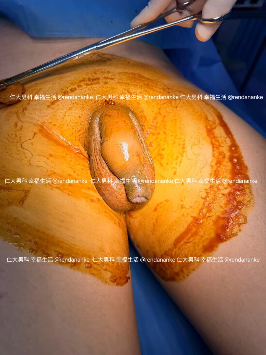 仁大医院男性私密整形 tweet media