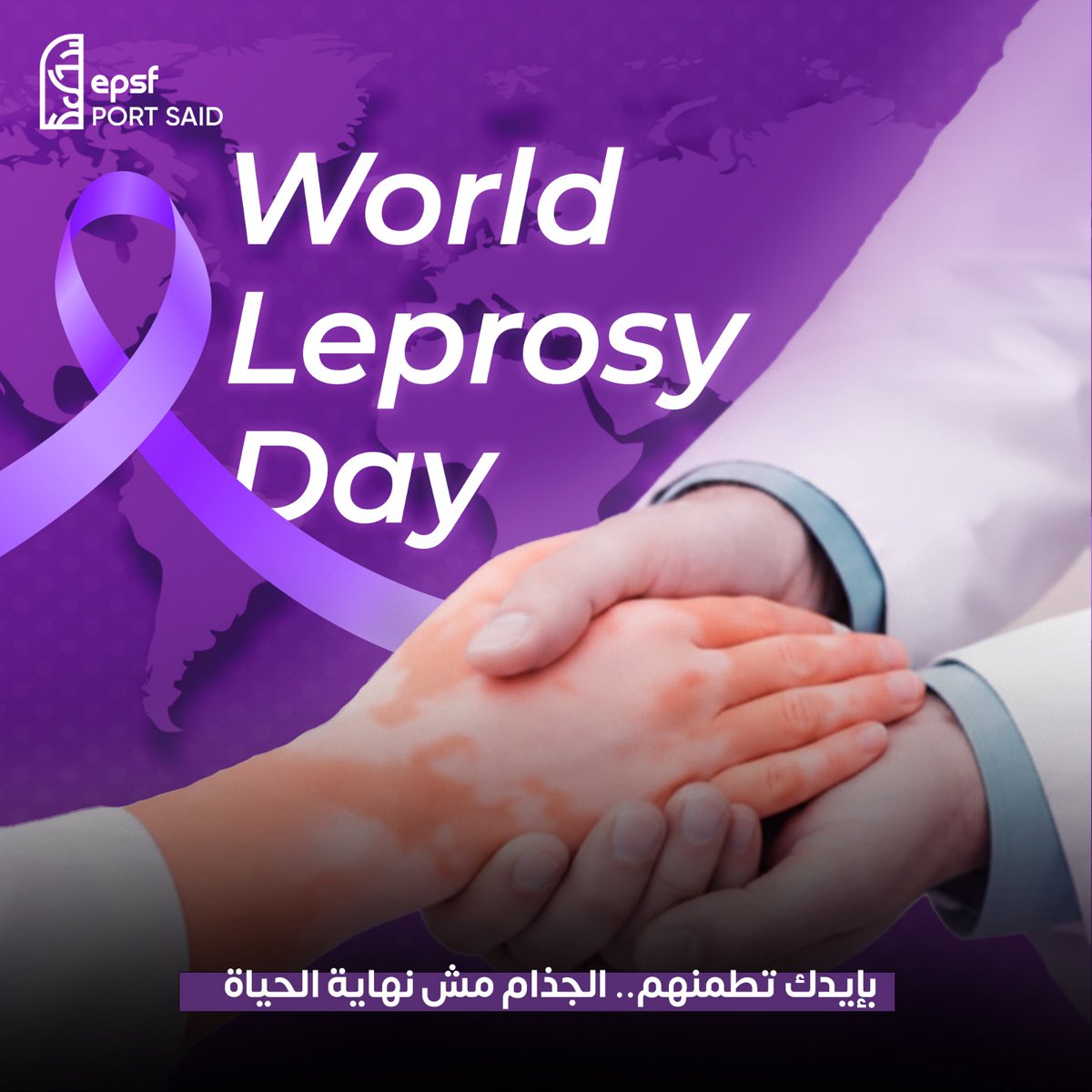 الجذام مش مرض انتهى…
هو موجود، قابل للعلاج، والخطر الحقيقي في التأخير والوصمة.
الوعي والتشخيص المبكر بيحموا حياة ناس كتير.

#EPSF_PortSaid
 #WHD
 #leprosy