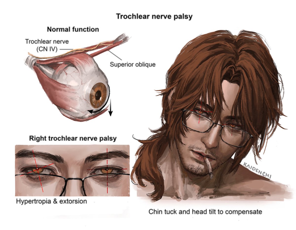 #림버스컴퍼니 #LCB13