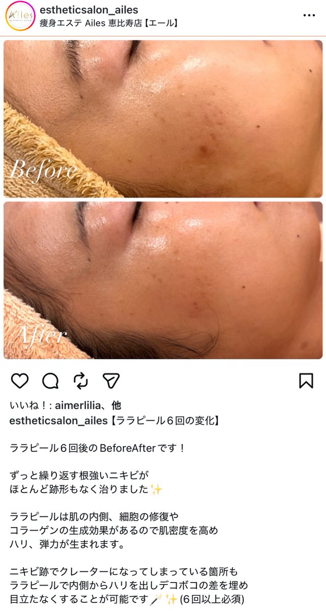 りのこ tweet media