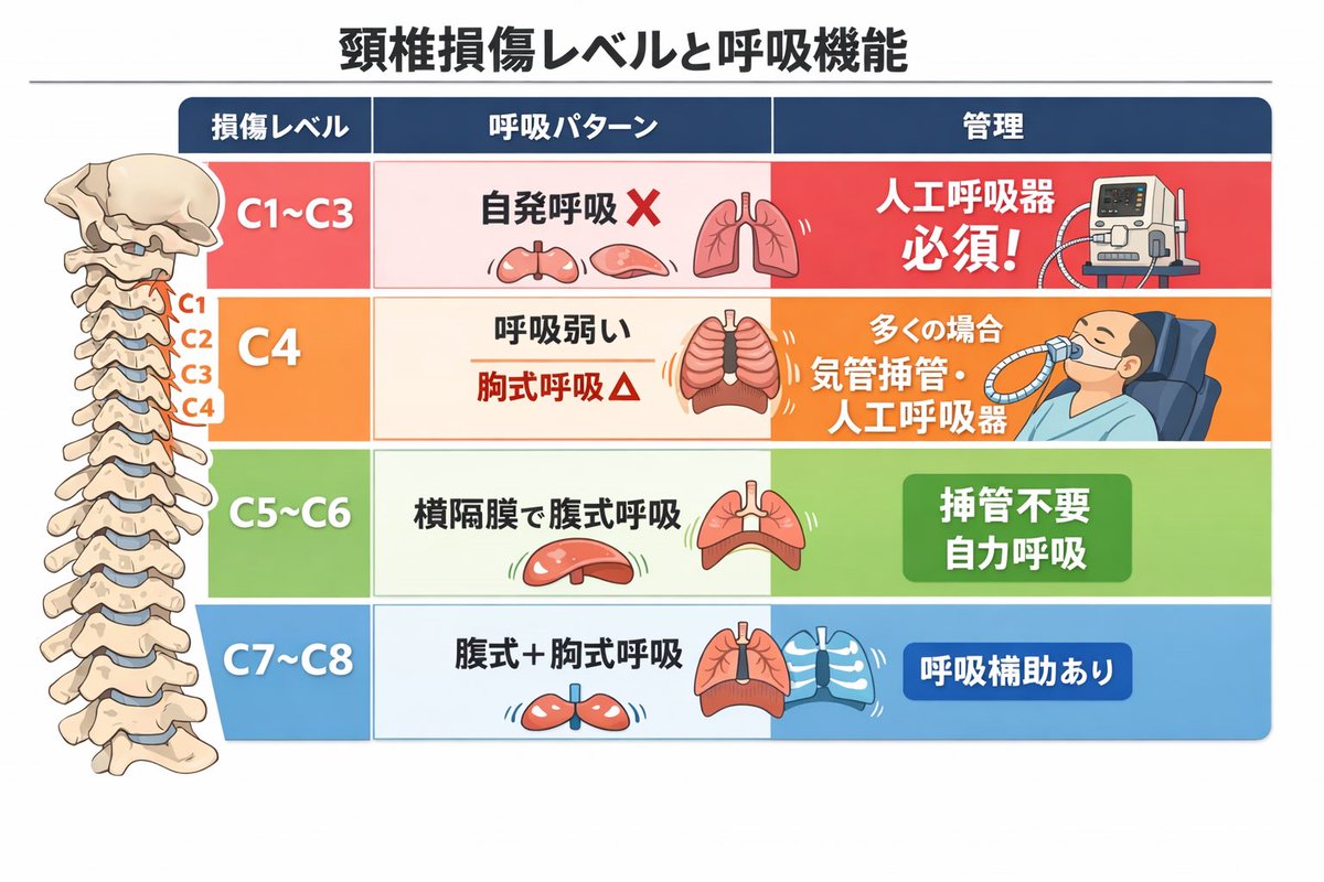 yumehaneat's tweet image. 脊髄損傷苦手すぎてちゃっぴーに作らせたなかなかわかりやすいじゃん♪