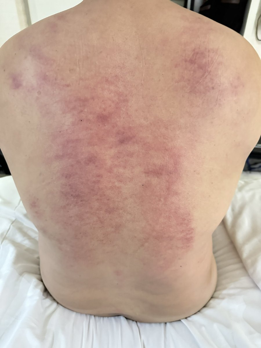 eff09333's tweet image. 今天桃園客人被我調理到酥麻啊？
真的有想念我的上翹肉棒嗎？
吹到整根含到底快吐了說很爽，整個臉部漲紅快無法呼吸了。頂到喉嚨最深處。
G點別人按5分鐘，你確按了15分鐘ㄧ直狂出水啊，弄到你不要不要床單也💦了。
雙腳自己抬高我想要肉棒啊？
什麼⋯⋯聽不清楚⋯⋯⋯上翹肉棒…