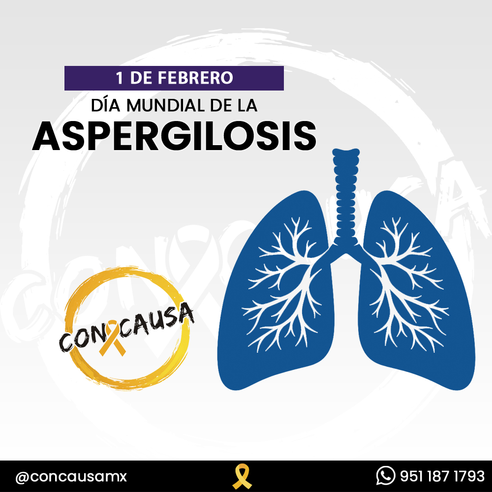 ConCausaMX's tweet photo. El Día Mundial de la Aspergilosis se celebra cada 1 de febrero para aumentar la conciencia global, promover la educación sanitaria y mejorar el diagnóstico de las infecciones fúngicas causadas por el hongo Aspergillus.
#Aspergilosis #ConCausa https://t.co/iB3pvnQOEA