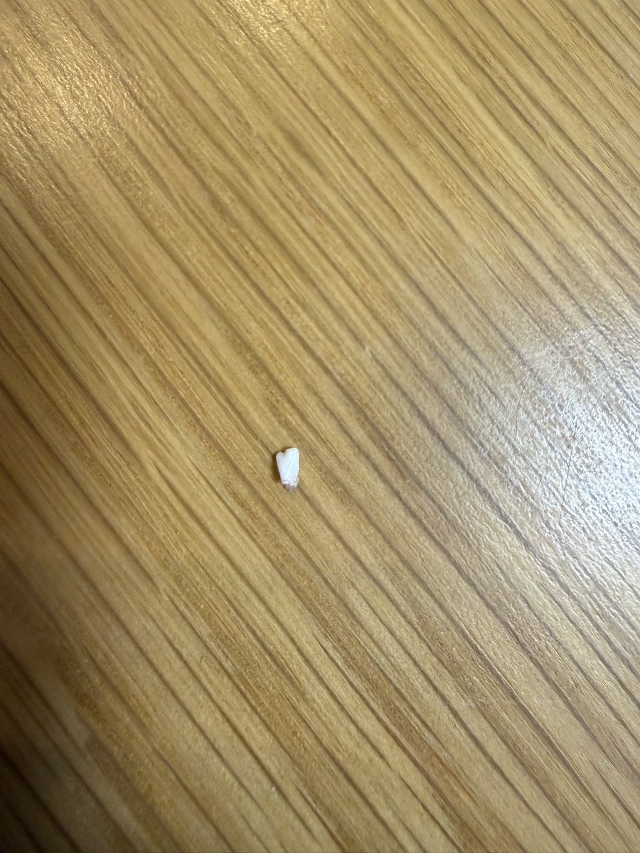 ker_0906's tweet photo. 子がなんか粒みたいの持ってるな…！？って思ったら、オルちゃんの歯🦷！！！！ https://t.co/WApHWGJM91