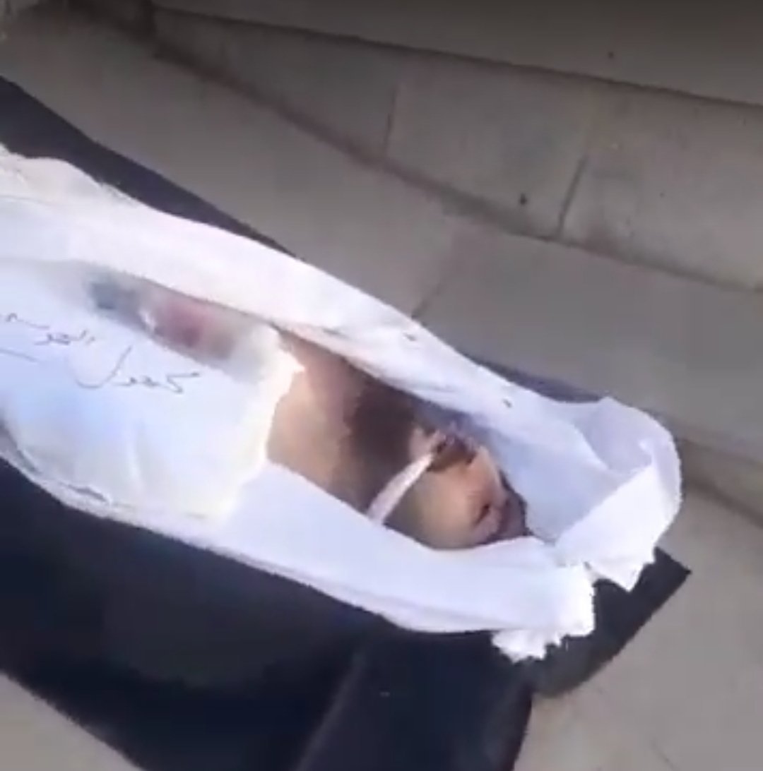 Body of a protester in Tehran 👇

They arrested and gagged him, and only then executed him under torture.