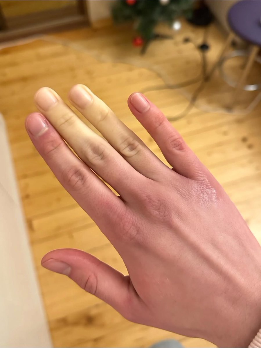 Виталя пишет код tweet media