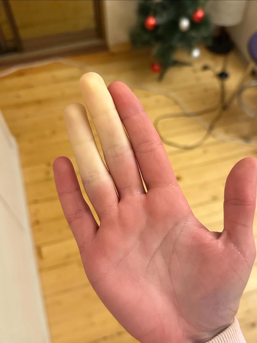 Виталя пишет код tweet media