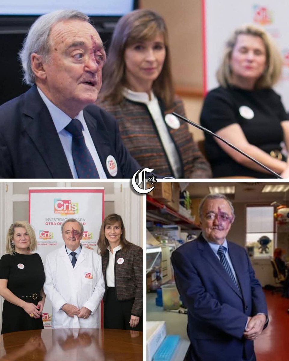 Durante anos, o câncer no pâncreas foi quase uma sentença silenciosa; hoje, o Dr. Mariano Barbacid mudou essa história ao alcançar a supressão completa e duradoura do tumor em modelos experimentais. 

Juntamente com sua equipe de pesquisa, elaborou uma estratégia que bloqueia