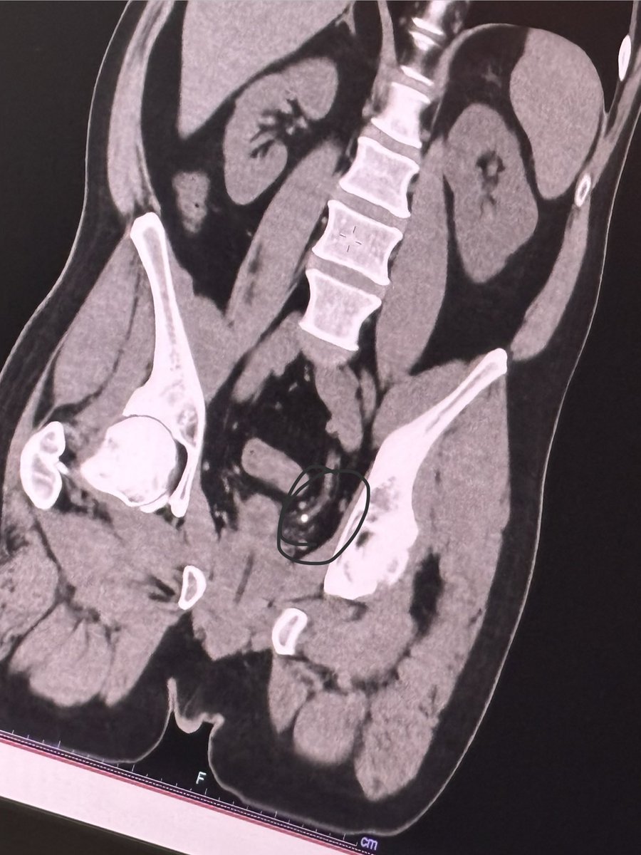 Mike Hunsucker tweet media