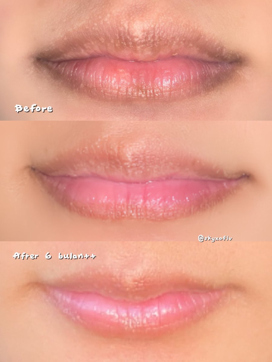 skyxoflv's tweet photo. in PARAGON we trust🙏🏻

This is THE underrated lip mask🔥 Hasil NYATA, marketing ga berisik, no overprice🫰🏻🫶🏻 https://t.co/mAj45a3GqR