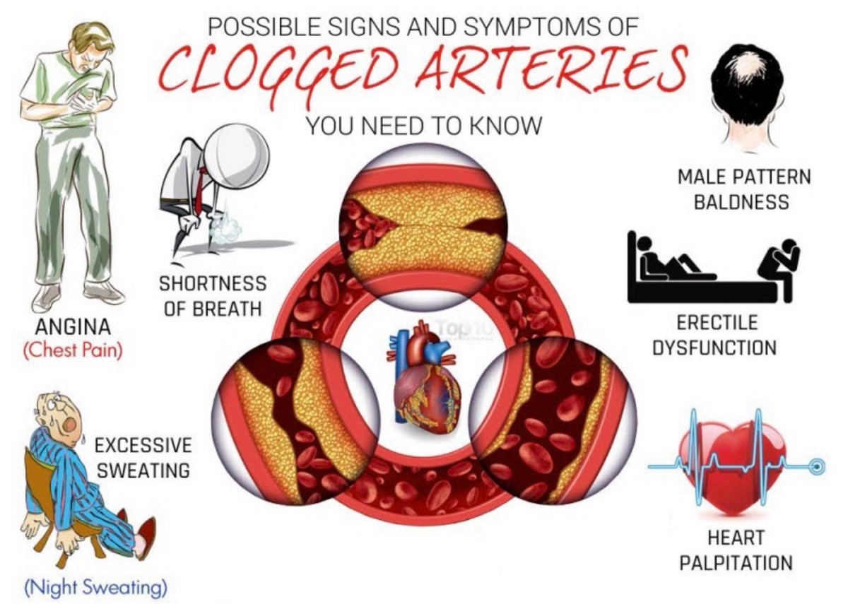 Can you explain what causes atherosclerosis without using the word cholesterol? 

Most can’t. 

Fewest words wins for those who can!