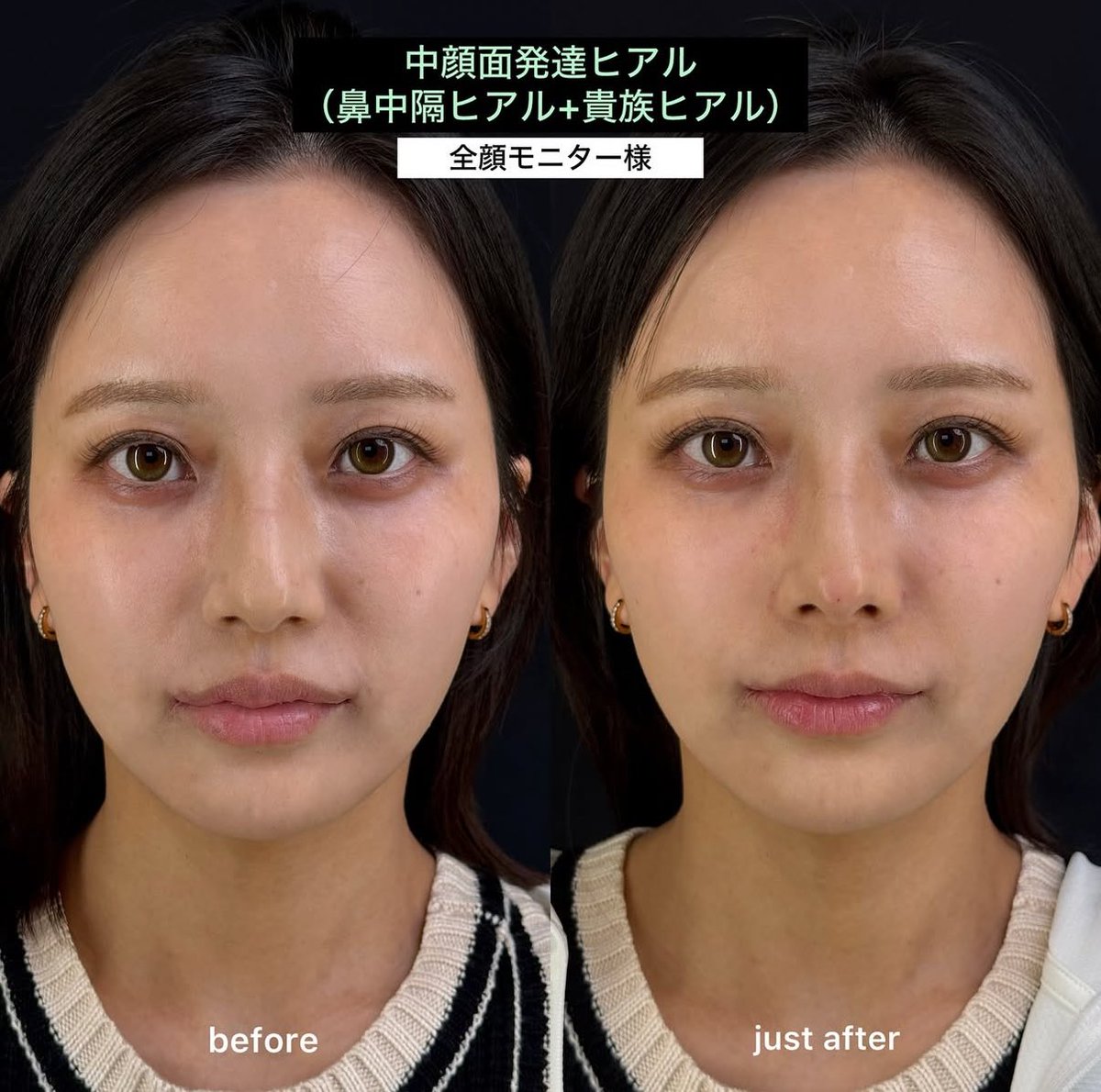 美容外科医さえら tweet media