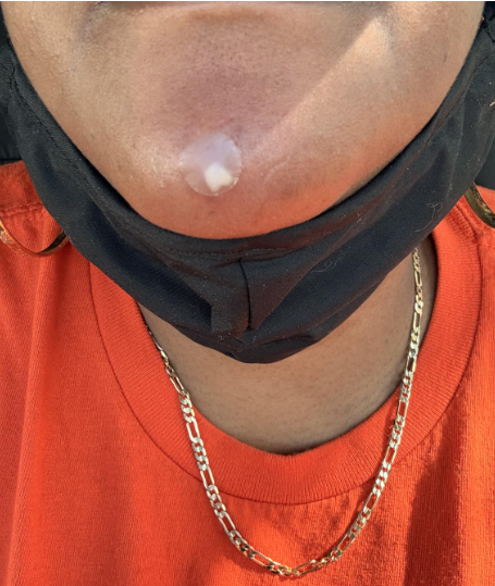 ItalyEstes's tweet photo. Best-seller on Amazon 🔥
Mighty Patch™ is a hydrocolloid acne patch that helps improve the look of pimples overnight ,no popping needed.
Works in 6–8 hours, stays on all night, and is gentle on all skin types.
👉 https://t.co/Qi22hTLr3c

#MightyPatch
#skincare 
#selfcare https://t.co/ep94NDq0J6