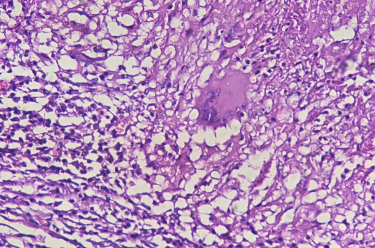 aung phyo tweet media