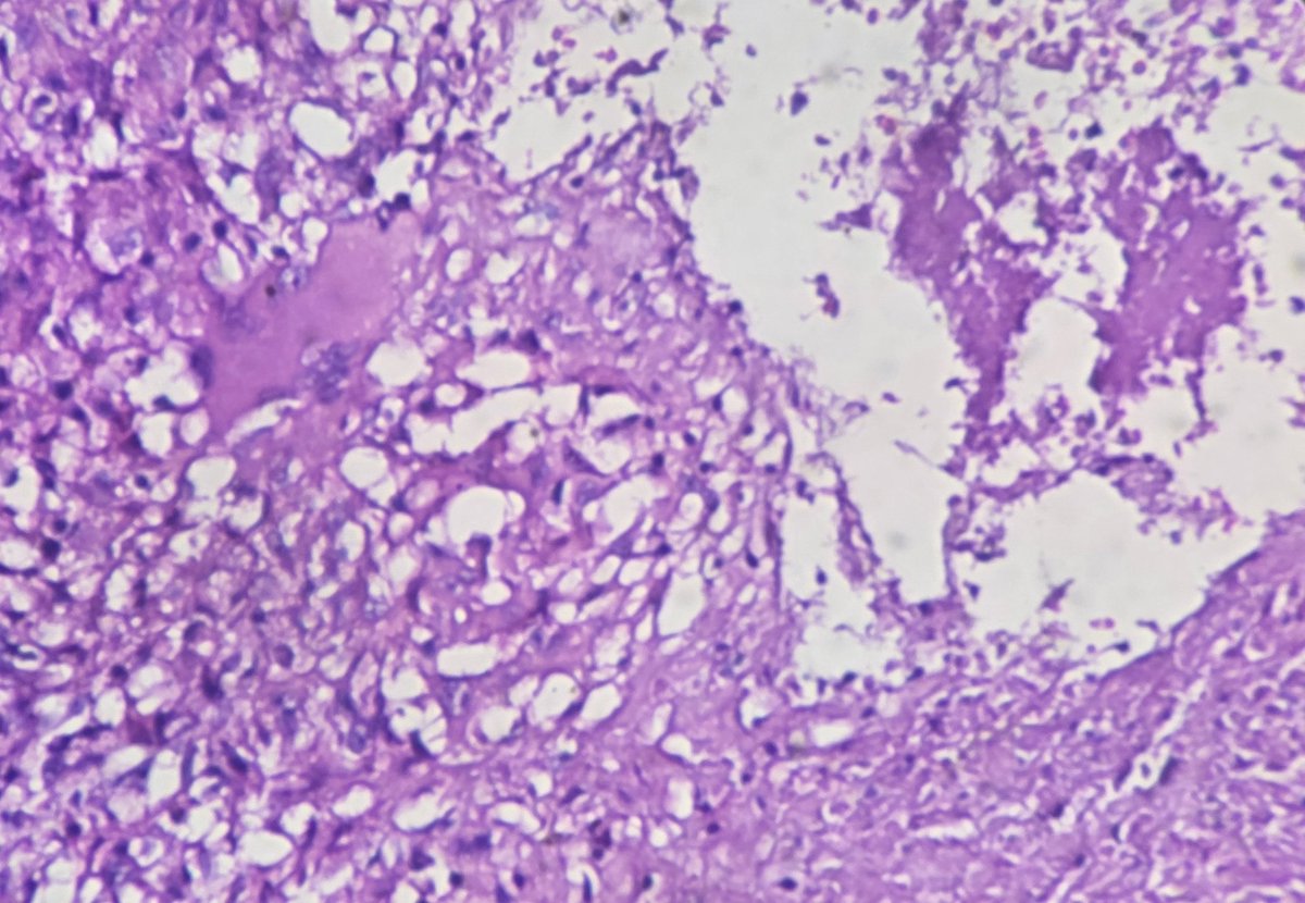 aung phyo tweet media