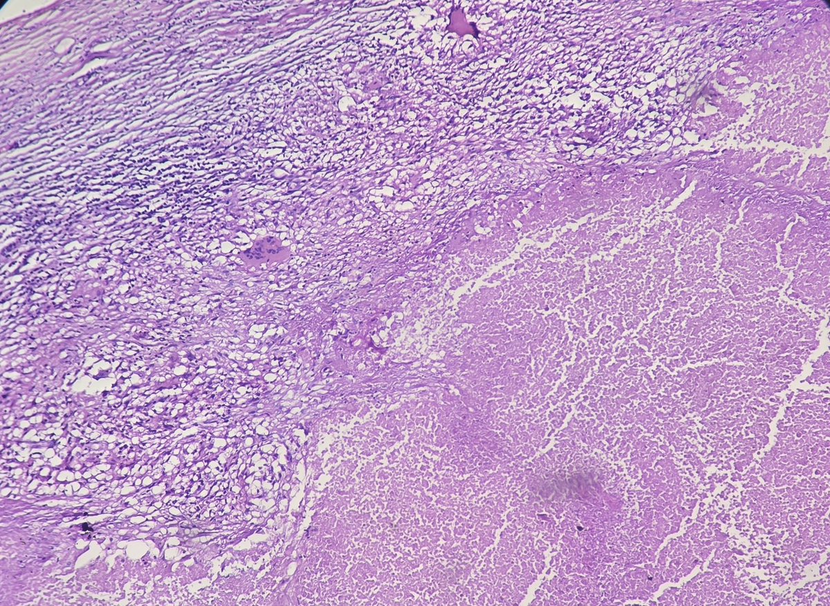 aung phyo tweet media