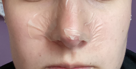 ItalyEstes's tweet photo. 14,000+ reviews on Amazon ⭐️

Mighty Patch™ Nose helps improve the look of pores and blackheads overnight.
Simple, gentle, and easy to use.
👉 Try it here: https://t.co/J3XfLCrwSS

#MightyPatch 
#SkincareFinds 
#MightyPatch
#MightyPatchNose
#HeroCosmetics
#NosePatch https://t.co/BkHoxsJLhD