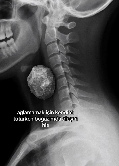 anlatsam kesin ağlarım