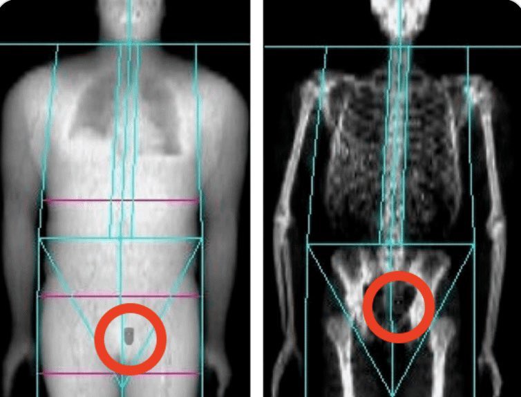 Hodlius ₿ Maximus tweet media