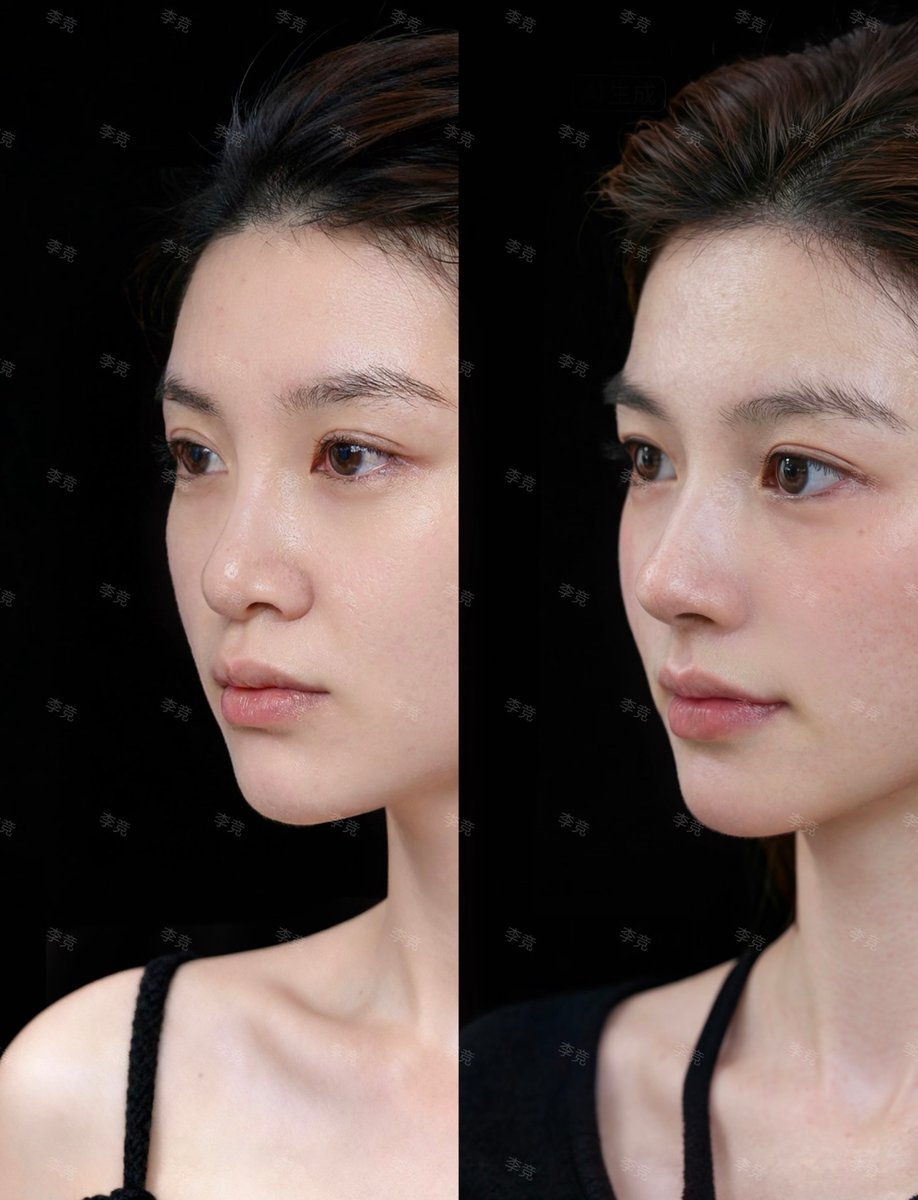 Qちゃん🫧 tweet media