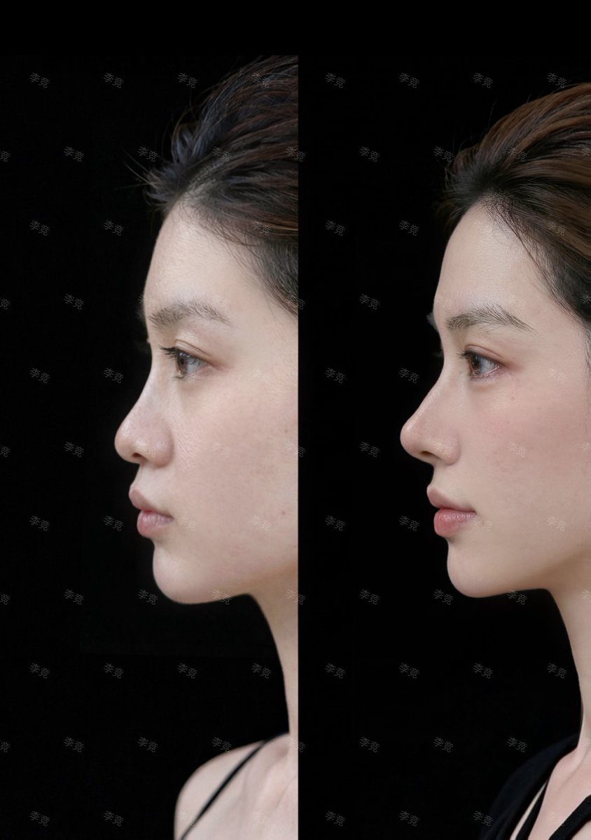 Qちゃん🫧 tweet media