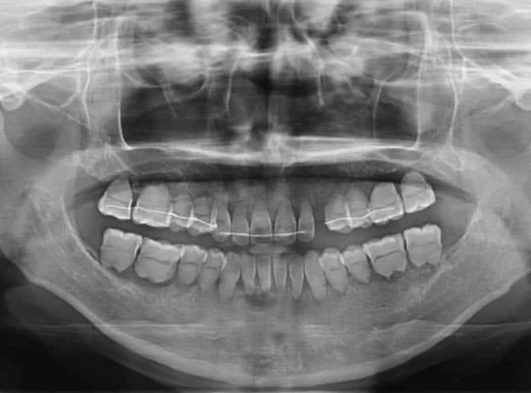 حالة غريبه منتشرة عالسوشيال ميديا
توقعاتكم؟!