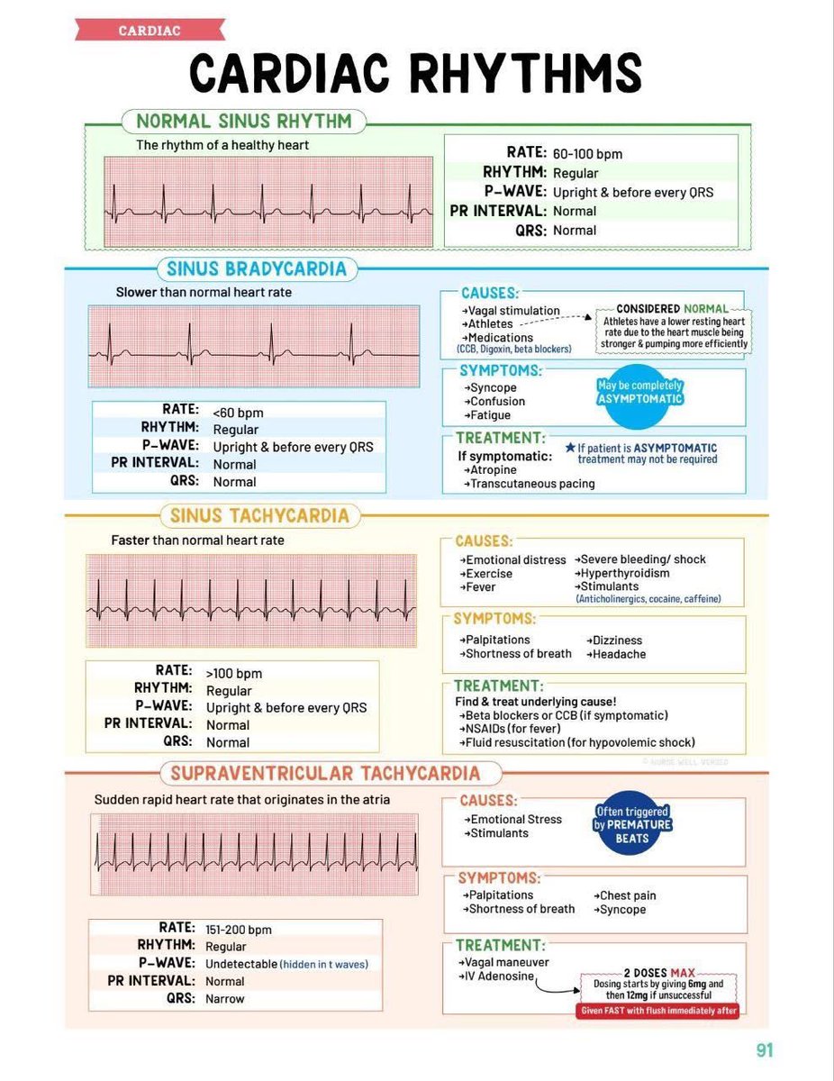 Common Heart Rythmns Common Cardiac rhythms #MedEd #MedTwitter #FOAMed