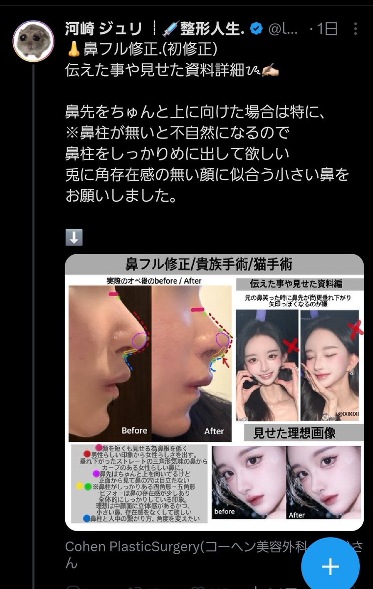 pgjbdmtmaw_'s tweet photo. 反社スカおすすめ整形垢
河崎ジュリ
またモニター割引手術かゆ🤣🤣散々コーへン叩いてきた人たちが黙ってるのキモすぎだゆ。 https://t.co/zULwjKmmAE