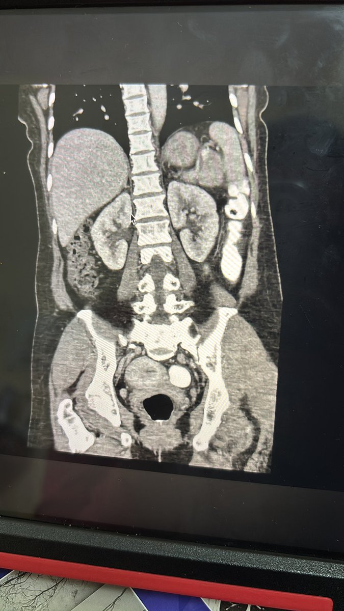 sarikabharti15's tweet photo. February start hogya pr LNJP ki CT machine nahi chali !🙃
#radiology 
#MAMC 
#LNJP https://t.co/w3oAIfNvTc