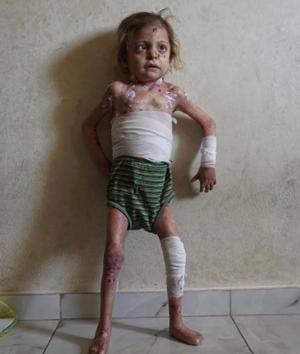 لا تتوقف عن النشر فصمتك خيانة