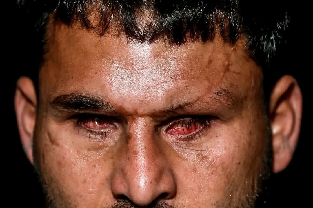 لعن اللّه الاحتلال بعدد أنفاس البشر.