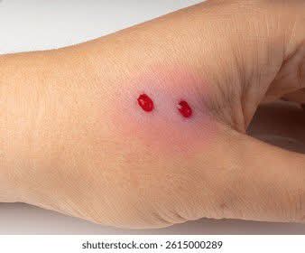 Tope_Orus's tweet photo. Snake incidents around homes in Abuja have become more frequent, especially during hot and rainy seasons. It’s scary, and awareness really matters. Here are clear signs that a snake may be around your house and what to watch out for:

🐍 Signs a Snake Is Around Your House
Snake skin (shedding)
Snakes shed their skin as they grow. If you see dry, transparent skin around the compound, ceilings, stores, or near water, take it seriously.

Strange sounds at night
Hissing, rustling, or crawling sounds in ceilings, grass, or dark corners, especially late at night.

Unusual movement of rats or frogs
If rats suddenly disappear or frogs gather around your compound, snakes may be hunting there.

Holes or cracks around the house
Snakes hide in cracks, soakaways, unsealed drainages, broken walls, and under slabs.

Strong, unusual smell
Some snakes release a musky smell. If you notice a strange odor in stores or corners, investigate carefully.

Pets behaving strangely
Dogs barking at one spot, chickens refusing to enter a corner, or sudden panic among animals can be a warning sign.
Overgrown grasses & scattered items
Bushy surroundings, firewood, blocks, zinc, or abandoned materials attract snakes.

🚫 How to Reduce the Risk
Clear bushes regularly around your house
Seal holes, cracks, and broken drainages

Keep food covered (rats attract snakes)
Raise firewood and building materials off the ground
Use torchlight at night when walking around
Keep doors closed, especially at night

 Please REPOST this, someone may need it today 🙏

May we not be a victim 🙏