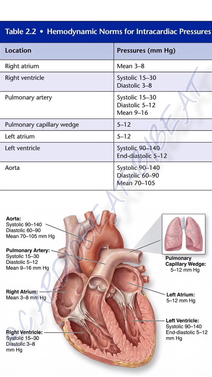 CardioBeat_'s tweet image. facebook.com/share/p/14akY9…
Hemodynamic norms for intracardiac pressures: Right heart systolic 15-30, diastolic 3-8 mmHg; left heart systolic 90-140, diastolic 5-12 mmHg. Aortic pressure 90-140/60-90 mmHg. Essential for clinical assessment. #Hemodynamics #Cardiology  #MedicalNorms