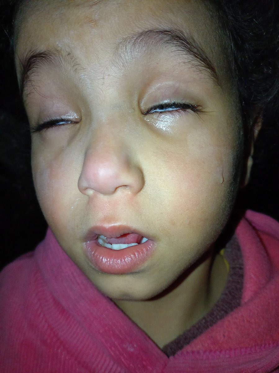 DalulainGaza's tweet image. MY CHILD IS DYING😭😫💔

︎
︎

︎

︎

︎

︎

we’ll remind you
︎

︎

︎

︎

︎
︎

︎

︎

︎

︎
︎

︎
︎

︎
︎

︎

︎

︎

︎
︎

︎

︎

︎
that
︎

︎

︎

︎

︎

︎
︎

︎

︎

︎

If you’re scrolling, PLEASE leave a dot . it's just a dot .
chuffed.org/project/138194…