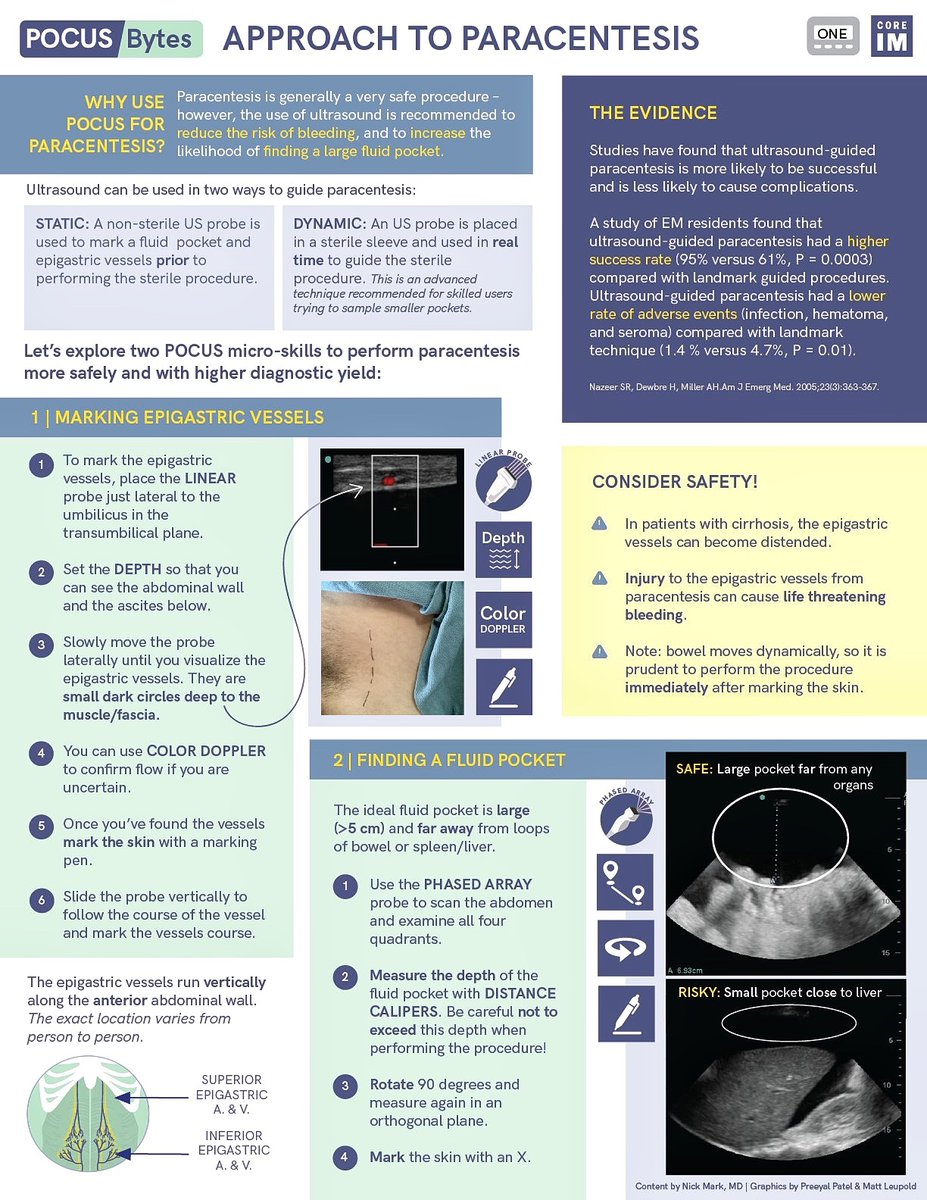 Approach to ultrasound guided paracentesis 🔦

📸: ⁦<a href="/COREIMpodcast/">CORE IM</a>⁩
