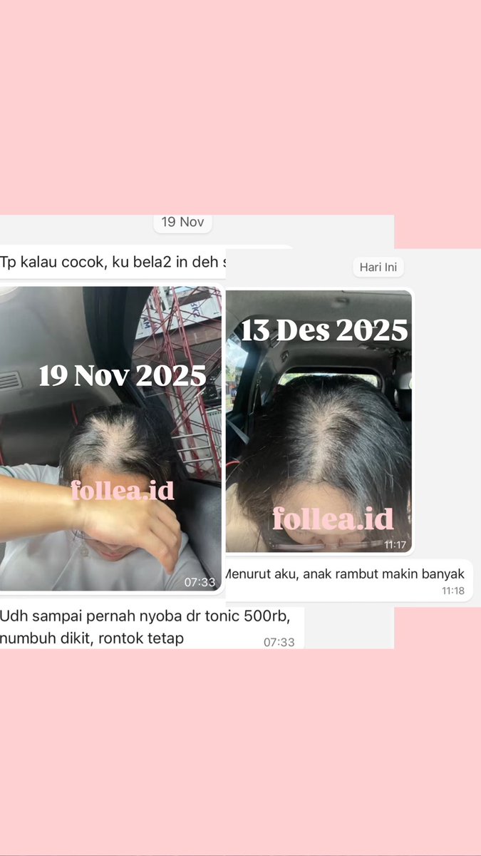 debbiiedebo's tweet photo. Hair Tonik Organik untuk Mengatasi Rambut Rontok dan Bantu menumbuhkan rambut lebih cepat!
Bahan yang dipake fresh organik aku beli dari Petani Urban Farming Lokal 😍🫶🏻
Yang terbaik adalah ONLY 35.000! https://t.co/r5DEvbOvhu