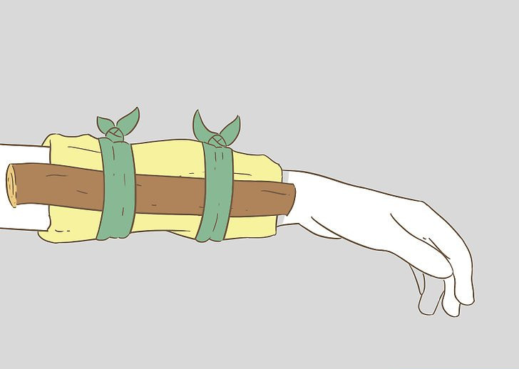 SavvyRinu's tweet photo. @SaintHambruz @Udee_Faith First image is splinting. Second image is tying https://t.co/Fp9bERXfKR