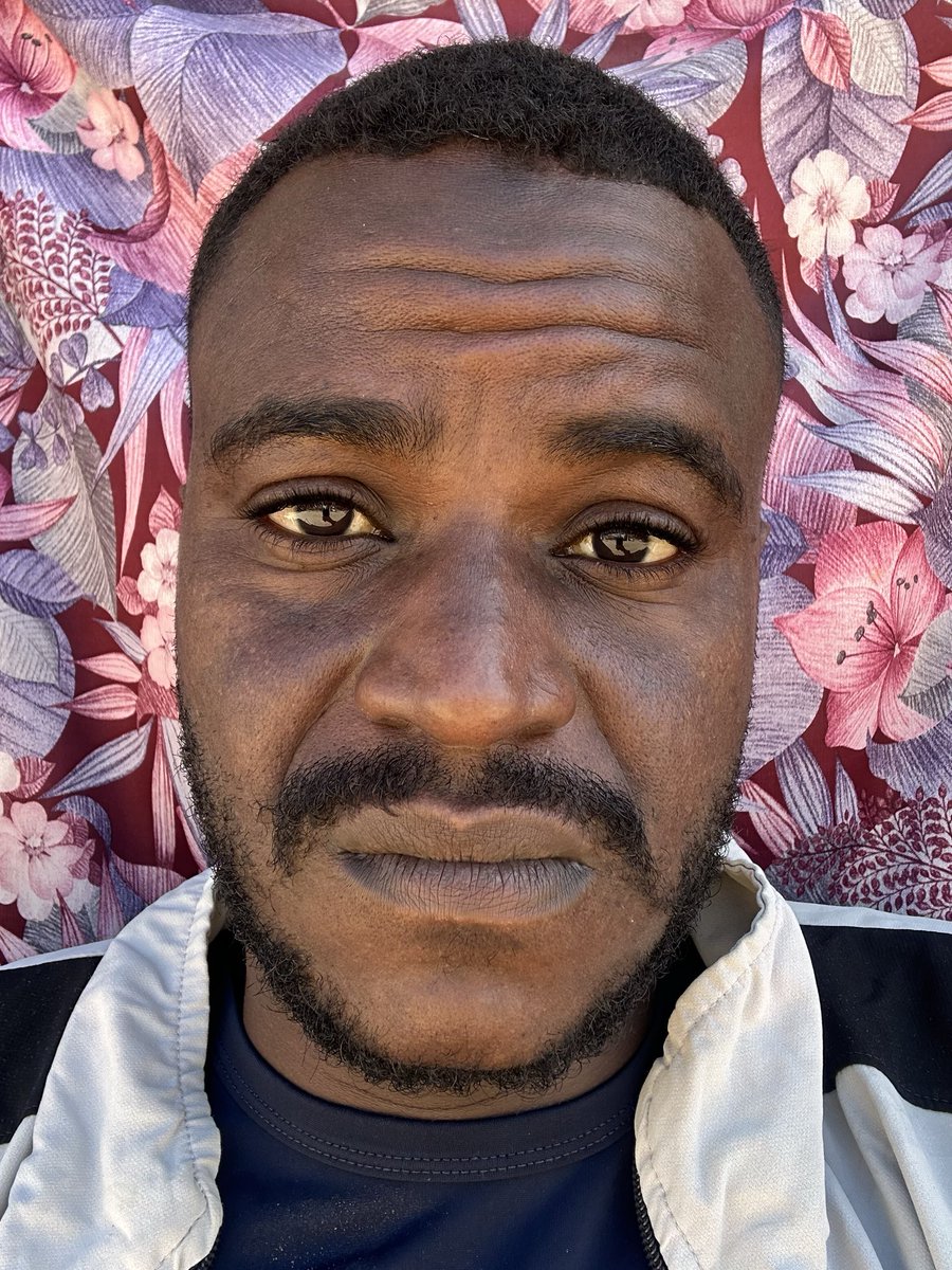 MuslehMay43064's tweet photo. I'm Tired!!!

PLEASE, DON'T LEAVE ME ALONE!!!

If you care, Please DONATE and RETWEET. Please reply with a dot. It's just a dot.

https://t.co/A456F1Evnp https://t.co/ipI8zeXh02