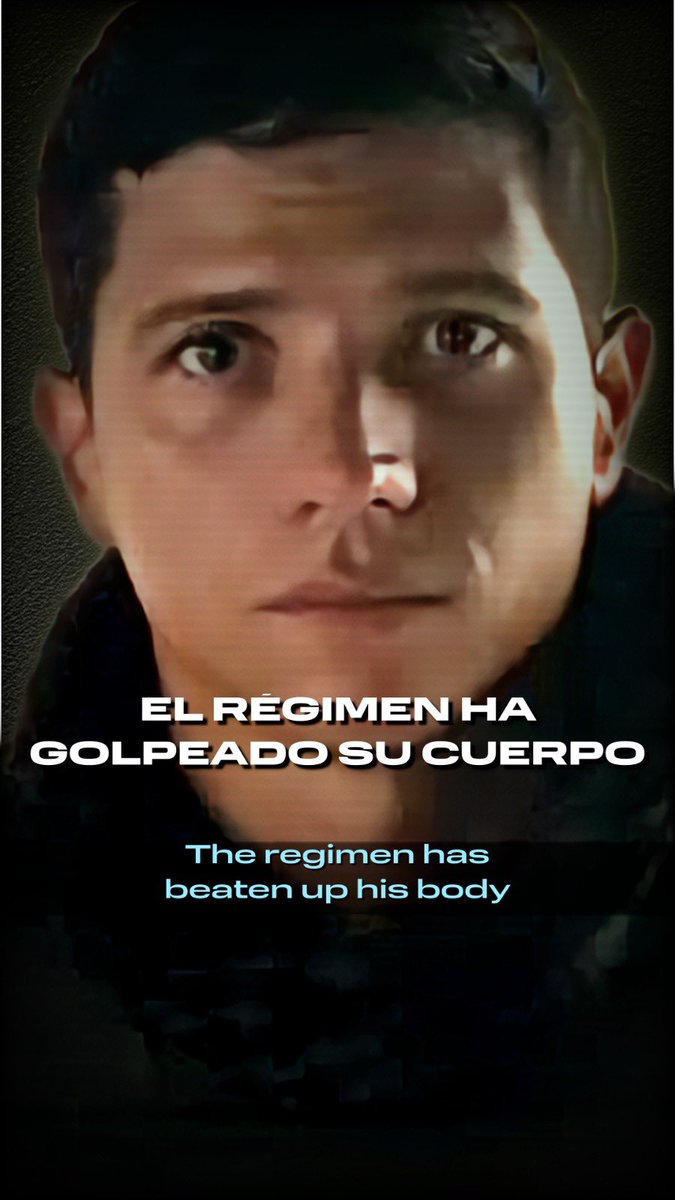 ConVzlaDenmark's tweet photo. El régimen ha golpeado tu cuerpo, Igbert, pero jamás tu honor. Cuando recuperes tu libertad, sanarás junto a Venezuela las heridas de la tortura. Exigimos tu liberación inmediata. #QueSeanTodos #LiberenAIgbert #PresosPoliticos #Venezuela #DDHH @liberenaigbert @MundoConVzla https://t.co/SWZeCfq1fv