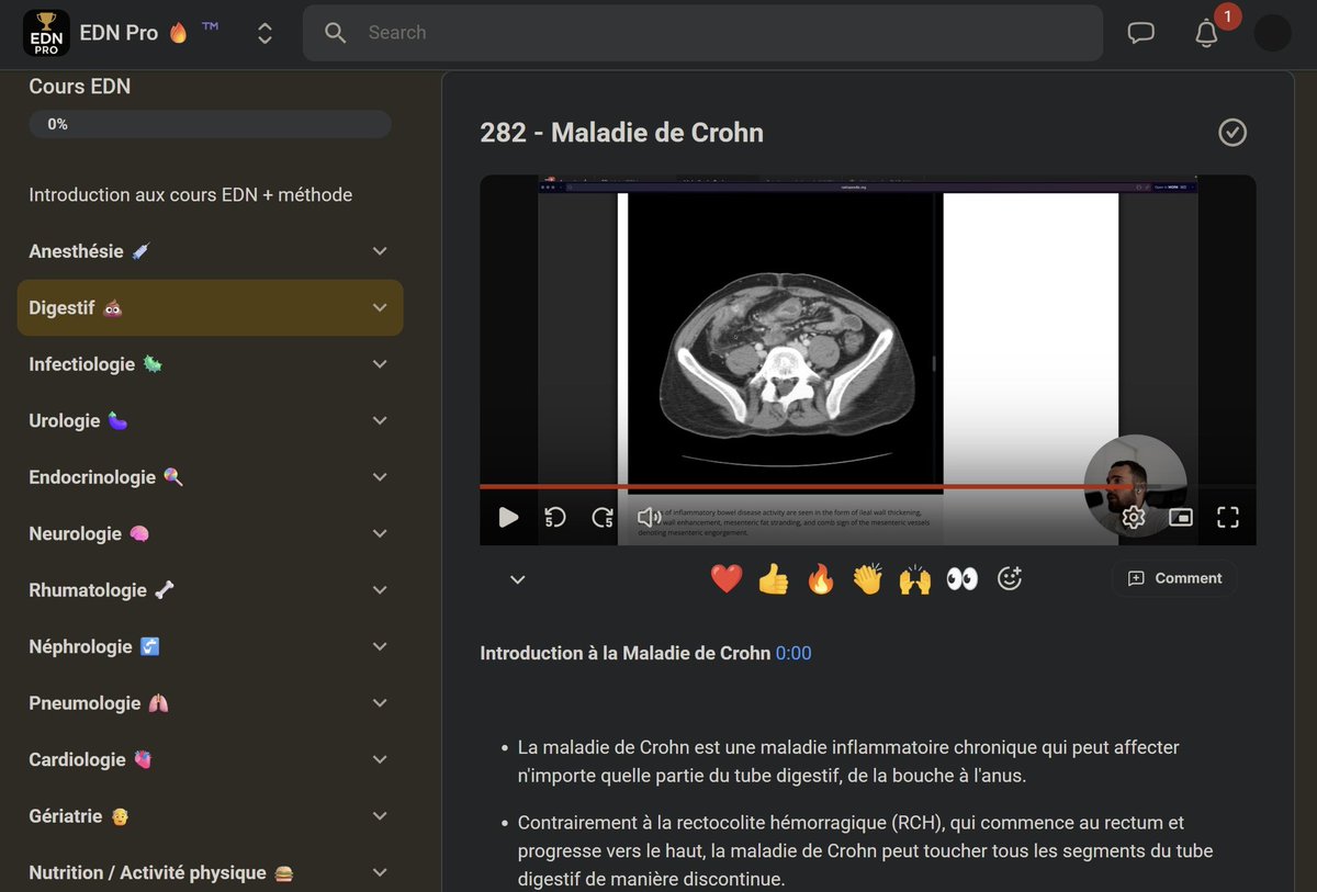 Huntersavant's tweet photo. Bon plan étudiant #7264 🎓

Un médecin top 300 à l’ECN a créé une plateforme avec TOUS les items de médecine expliqué 1 à 1 en vidéo !

Le taff et la qualité c’est INCROYABLE c’est pour ça que je vous le partage, par pitié allez jetez un oeil ça vaut le coup +++ 👇 

https://t.co/3xmm2TlYaC