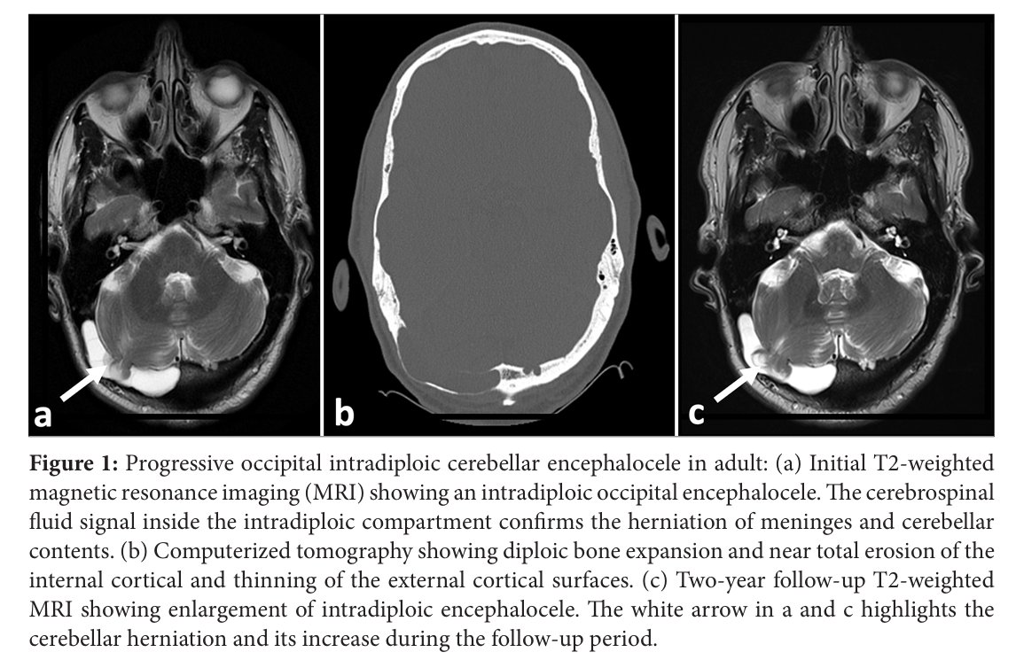 King's Neurosurgery tweet media