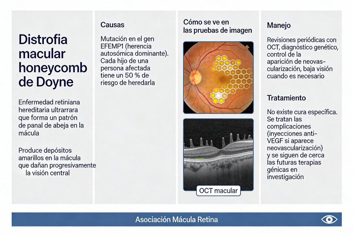 Mácula Retina tweet media