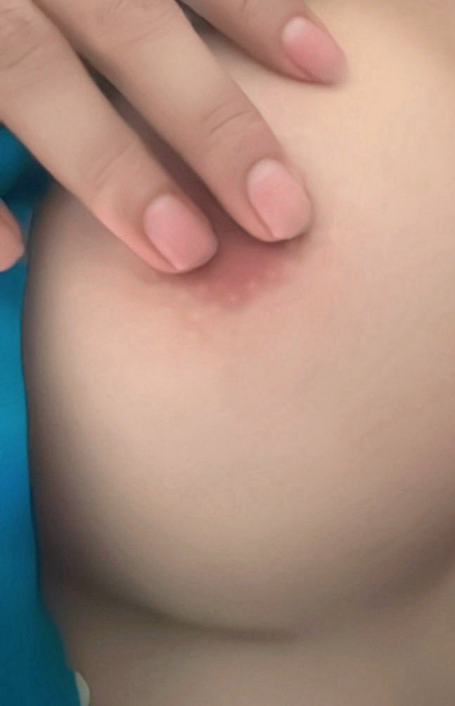 ขอวิธีแก้นมแตกหน่อยงับ55555 #จันทบุรี