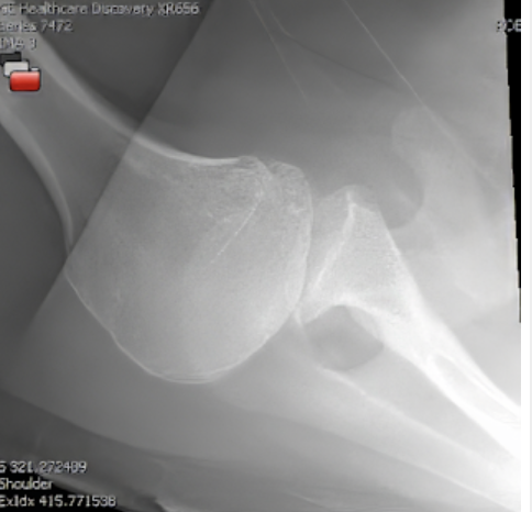 Rick Matsen tweet media